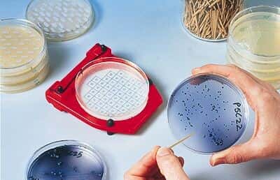 Disadvantages of replica plating picture