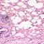 Cole-Parmer Prepared Slide, Human Lung Tissue, Normal Cole-Parmer Prepared Slide, Human Lung Tissue, Normal