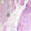 Cole-Parmer Prepared Slide, Human Stomach Tissue, Ulcer Cells Cole-Parmer Prepared Slide, Human Stomach Tissue, Ulcer Cells