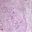 Cole-Parmer Prepared Slide, Human Stomach Tissue, Ulcer Cells Cole-Parmer Prepared Slide, Human Stomach Tissue, Ulcer Cells