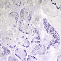 Cole-Parmer Prepared Slide, Animal Cell Mitosis, Grasshopper Testis, Mitosis