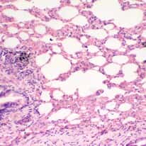 Cole-Parmer Prepared Slide, Human Lung Tissue, Normal