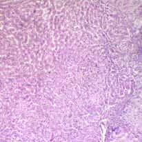 Cole-Parmer Prepared Slide, Human Liver Cells, Cirrhosis