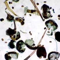 Cole-Parmer Prepared Slide, Fern Spores Germinating