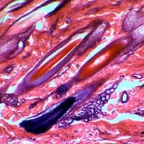 Cole-Parmer Prepared Slide, Human Scalp, Vs