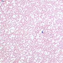 Cole-Parmer Prepared Slide, Human Blood Smear, Wright's Stain