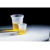 Disposable polypropylene Griffin low-form beakers, 30 mL 100/cs