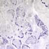 Cole-Parmer Prepared Slide, Animal Cell Mitosis, Grasshopper Testis, Mitosis