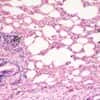 Cole-Parmer Prepared Slide, Human Lung Tissue, Normal