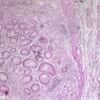 Cole-Parmer Prepared Slide, Human Stomach Tissue, Ulcer Cells
