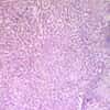 Cole-Parmer Prepared Slide, Human Liver Cells, Cirrhosis
