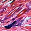 Cole-Parmer Prepared Slide, Human Scalp, Vs