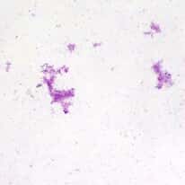 Cole-Parmer® Prepared Microscope Slides, Bacteria and Fungi